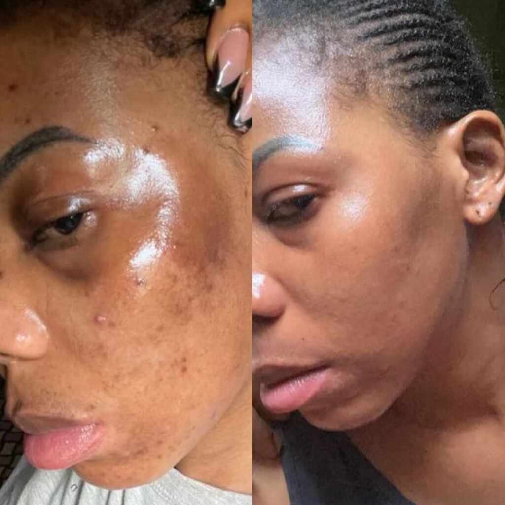 Customer skin before and after using SBS products